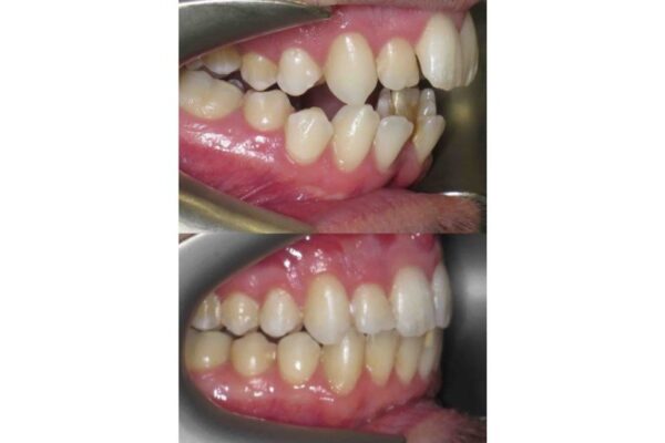 B_A2_33d9266f-8968-42d9-bacd-123d1df6be23-768x523